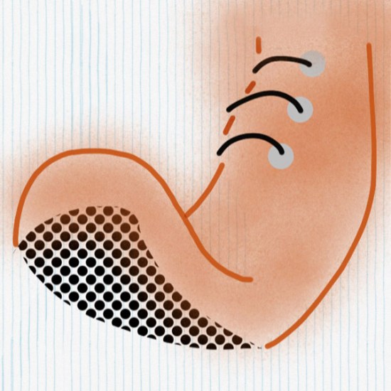 chato-de-galocha1_p2